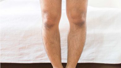 تشخيص حنف القدم والعلاج في الوقت المناسب