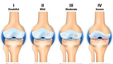 ما هو التهاب مفاصل الركبة؟